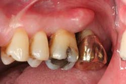 16feb18piafroum Clintip02b 16feb18piafroum Clintip02b