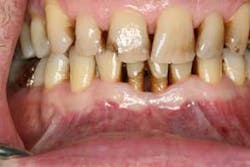 16feb18piafroum Clintip03 16feb18piafroum Clintip03