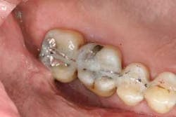 16feb18piafroum Clintip04 16feb18piafroum Clintip04