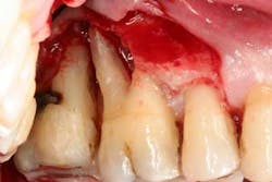 16feb18piafroum Clintip05a 16feb18piafroum Clintip05a