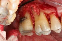 16feb18piafroum Clintip05b 16feb18piafroum Clintip05b