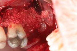 16feb18piafroum Clintip06b 16feb18piafroum Clintip06b