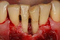 16feb18piafroum Clintip07a 16feb18piafroum Clintip07a