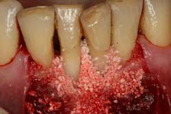 16feb18piafroum Clintip07b 16feb18piafroum Clintip07b