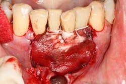 16feb18piafroum Clintip07c 16feb18piafroum Clintip07c