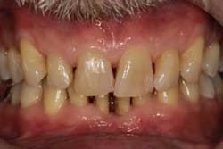 16feb18piafroum Clintip09 16feb18piafroum Clintip09