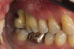 16feb18piafroum Clintip10 16feb18piafroum Clintip10