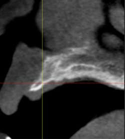 14oct23srrmannfroum02 14oct23srrmannfroum02