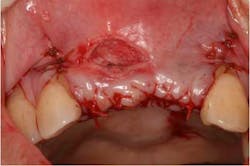 14oct23srrmannfroum11 14oct23srrmannfroum11