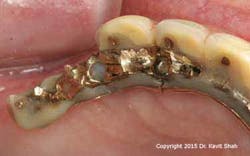 15jun18padvshah01 W 15jun18padvshah01 W