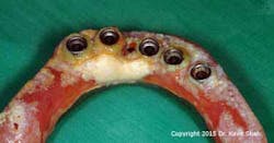 15jun18padvshah03 W 15jun18padvshah03 W