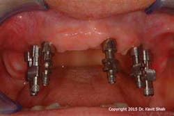 15jun18padvshah04 W 15jun18padvshah04 W