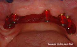 15jun18padvshah05 W 15jun18padvshah05 W