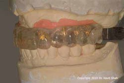 15jun18padvshah07 W 15jun18padvshah07 W