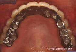 15jun18padvshah11 W 15jun18padvshah11 W