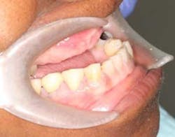 16mar17piamann01 16mar17piamann01