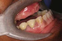 16mar17piamann02 16mar17piamann02