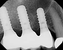 16may19piagoldstein01a 16may19piagoldstein01a