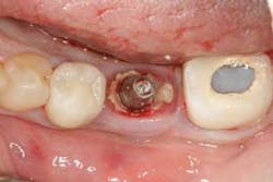 16jul28piagobwei02 16jul28piagobwei02