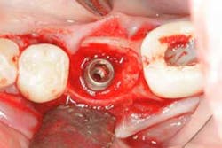 16jul28piagobwei03 16jul28piagobwei03