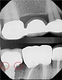 16jul28piagobwei04 16jul28piagobwei04