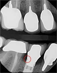 16jul28piagobwei07 16jul28piagobwei07