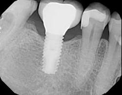 16jul28piagobwei11 16jul28piagobwei11