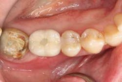 16jul28piagobwei12 16jul28piagobwei12