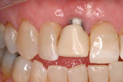 16sept15piafroum P01 16sept15piafroum P01