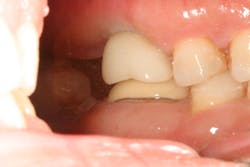 16sept15piafroum P02 16sept15piafroum P02