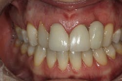 16sept15piafroum P03 16sept15piafroum P03