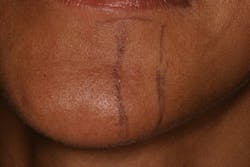 17jan12piafroum03 17jan12piafroum03