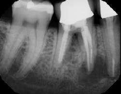 17jan12piafroum04 17jan12piafroum04