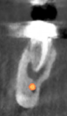 17jan12piafroum05 17jan12piafroum05