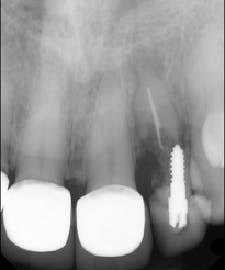 17jan12piamann01 17jan12piamann01