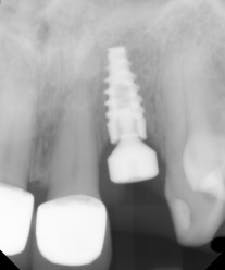 17jan12piamann02 17jan12piamann02