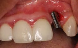 17jan12piamann03 17jan12piamann03