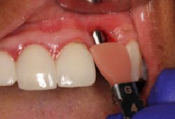 17jan12piamann04 17jan12piamann04