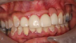 17jan12piamann05 17jan12piamann05