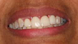 17jan12piamann06 17jan12piamann06