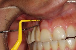 17jan12piamann07a 17jan12piamann07a