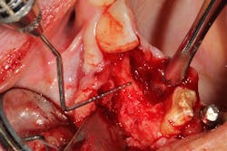 17jan12piamann08 17jan12piamann08