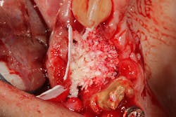 17jan12piamann08a 17jan12piamann08a