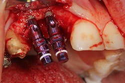 17jan12piamann09 17jan12piamann09