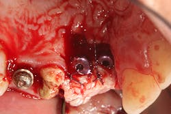 17jan12piamann10 17jan12piamann10