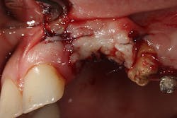 17jan12piamann10a 17jan12piamann10a