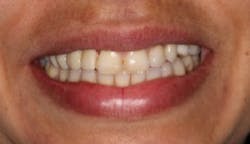 17jan12piamann11 17jan12piamann11