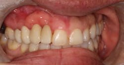 17jan12piamann11a 17jan12piamann11a