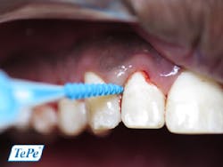 17feb9piainsanity P03 17feb9piainsanity P03