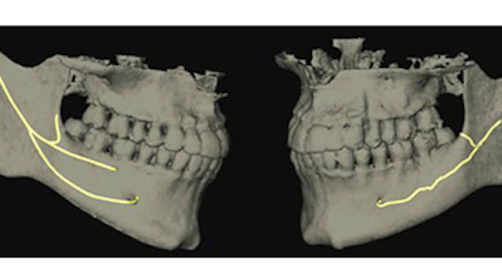 Top 5 sources of dental implant pain when 'there is nothing wrong with the implant' | Perio-Implant Advisory Top 5 sources of dental implant pain when 'there is nothing wrong with the implant' | Perio-Implant Advisory